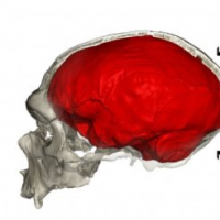 尼安德特人基因为人类大脑进化提供线索