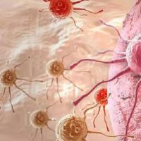 研究人员发现阻断肿瘤信号可阻止癌症扩散